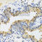 UV Radiation Resistance Associated antibody, A8462, ABclonal Technology, Immunohistochemistry paraffin image 