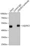 Ubiquinol-Cytochrome C Reductase Core Protein 2 antibody, GTX33573, GeneTex, Immunoprecipitation image 