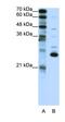 Recoverin antibody, orb324755, Biorbyt, Western Blot image 