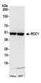 Regulator Of Chromosome Condensation 1 antibody, A300-866A, Bethyl Labs, Western Blot image 