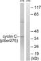 Cyclin-C antibody, LS-C198860, Lifespan Biosciences, Western Blot image 