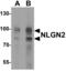 Neuroligin 2 antibody, PA5-72822, Invitrogen Antibodies, Western Blot image 