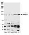 Ankyrin Repeat And FYVE Domain Containing 1 antibody, A305-512A, Bethyl Labs, Western Blot image 