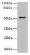Solute Carrier Family 46 Member 3 antibody, CSB-PA773784LA01HU, Cusabio, Western Blot image 