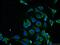 Protein Phosphatase 2 Regulatory Subunit Bbeta antibody, 13123-1-AP, Proteintech Group, Immunofluorescence image 