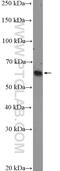 Cyclin Dependent Kinase Inhibitor 1C antibody, 23317-1-AP, Proteintech Group, Western Blot image 