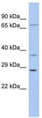 HASH1 antibody, TA330315, Origene, Western Blot image 