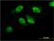 FLJ98241 antibody, H00220594-M03, Novus Biologicals, Immunofluorescence image 