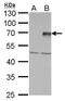 Protein Inhibitor Of Activated STAT 4 antibody, PA5-29146, Invitrogen Antibodies, Western Blot image 