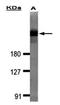 Dedicator of cytokinesis protein 1 antibody, orb74038, Biorbyt, Western Blot image 
