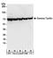 LRG antibody, A304-043A, Bethyl Labs, Western Blot image 