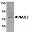 Protein Inhibitor Of Activated STAT 3 antibody, TA319815, Origene, Western Blot image 