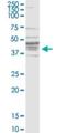 BKRB1 antibody, H00000623-M04, Novus Biologicals, Western Blot image 