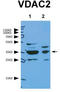 Voltage-dependent anion-selective channel protein 2 antibody, TA338534, Origene, Western Blot image 