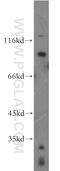 Fibroblast growth factor receptor 2 antibody, 13042-1-AP, Proteintech Group, Western Blot image 
