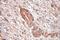 Signal Recognition Particle 9 antibody, 11195-1-AP, Proteintech Group, Immunohistochemistry paraffin image 