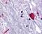 Bombesin Receptor Subtype 3 antibody, 48-158, ProSci, Immunohistochemistry paraffin image 