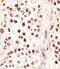 Heterogeneous nuclear ribonucleoprotein G antibody, M04738, Boster Biological Technology, Immunohistochemistry paraffin image 