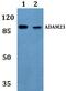 Disintegrin and metalloproteinase domain-containing protein 23 antibody, A07382, Boster Biological Technology, Western Blot image 
