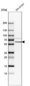 Internexin Neuronal Intermediate Filament Protein Alpha antibody, NBP1-81007, Novus Biologicals, Western Blot image 