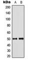 Septin 8 antibody, LS-C354505, Lifespan Biosciences, Western Blot image 