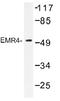 Putative EGF-like module-containing mucin-like hormone receptor-like 4 antibody, AP01313PU-N, Origene, Western Blot image 