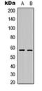 Tyrosine Hydroxylase antibody, LS-C358879, Lifespan Biosciences, Western Blot image 
