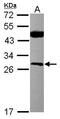 Casein kinase II subunit beta antibody, PA5-27416, Invitrogen Antibodies, Western Blot image 