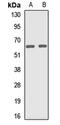 VPS33B Late Endosome And Lysosome Associated antibody, LS-C668344, Lifespan Biosciences, Western Blot image 