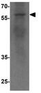 Cysteine protease ATG4C antibody, GTX31585, GeneTex, Western Blot image 