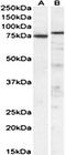 Tumor Protein P63 antibody, orb22563, Biorbyt, Western Blot image 