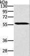 SLC29A4 antibody, LS-C402033, Lifespan Biosciences, Western Blot image 