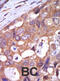 Protein Kinase D1 antibody, abx033121, Abbexa, Immunohistochemistry frozen image 