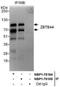 Zinc Finger And BTB Domain Containing 44 antibody, NBP1-78185, Novus Biologicals, Western Blot image 