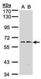 Flavin Containing Dimethylaniline Monoxygenase 1 antibody, PA5-21555, Invitrogen Antibodies, Western Blot image 