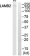 PMS1 Homolog 2, Mismatch Repair System Component antibody, TA313327, Origene, Western Blot image 