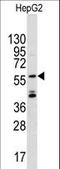 Angel Homolog 2 antibody, LS-C98625, Lifespan Biosciences, Western Blot image 
