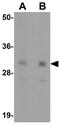 Nanog Homeobox antibody, GTX31400, GeneTex, Western Blot image 