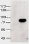 Ald antibody, PA5-18967, Invitrogen Antibodies, Western Blot image 