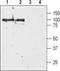 D(3) dopamine receptor antibody, TA328800, Origene, Western Blot image 