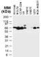 Tumor Necrosis Factor Receptor Associated Factor 3 antibody, NB100-56176, Novus Biologicals, Western Blot image 