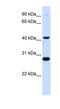 Cytochrome b-561 antibody, NBP1-62715, Novus Biologicals, Western Blot image 
