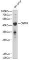 Ciliary neurotrophic factor receptor subunit alpha antibody, 14-414, ProSci, Western Blot image 