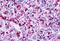 C-C chemokine receptor type 8 antibody, NLS3847, Novus Biologicals, Immunohistochemistry paraffin image 