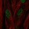 Chromosome 17 Open Reading Frame 107 antibody, HPA069713, Atlas Antibodies, Immunofluorescence image 