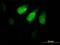ZPR1 Zinc Finger antibody, H00008882-B01P, Novus Biologicals, Immunofluorescence image 
