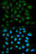 SH2 Domain Containing 1A antibody, A1143, ABclonal Technology, Immunofluorescence image 