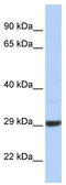 Zinc Finger CCHC-Type Containing 24 antibody, TA330941, Origene, Western Blot image 