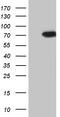 Phosphoinositide Kinase, FYVE-Type Zinc Finger Containing antibody, TA810374, Origene, Western Blot image 