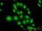 ATF4 antibody, H00000468-M01, Novus Biologicals, Immunocytochemistry image 
